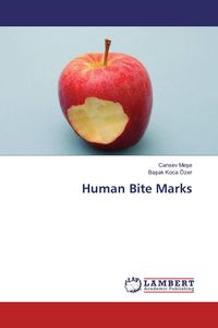 Produktbild: Human Bite Marks