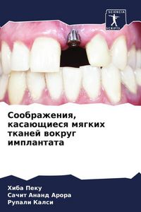 Produktbild: Soobrazheniq, kasa&uuml;schiesq mqgkih tkanej wokrug implantata