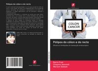 Produktbild: P&oacute;lipos do c&oacute;lon e do recto
