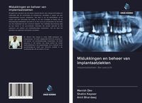 Produktbild: Mislukkingen en beheer van implantaatziekten