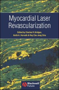 Produktbild: Myocardial Laser Revascularization