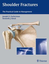 Produktbild: Shoulder Fractures