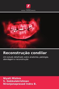 Produktbild: Reconstru&ccedil;&atilde;o condilar