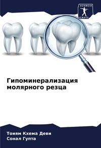 Produktbild: Gipomineralizaciq molqrnogo rezca