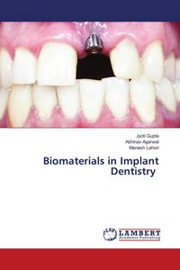 Produktbild: Biomaterials in Implant Dentistry