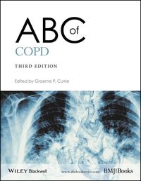 Produktbild: Abc Of Copd