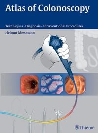 Produktbild: Atlas of Colonoscopy