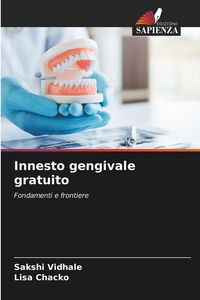 Produktbild: Innesto gengivale gratuito