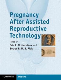 Produktbild: Pregnancy After Assisted Reproductive Technology