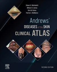 Produktbild: Andrews' Diseases of the Skin Clinical Atlas,E-Book