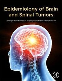 Produktbild: Epidemiology of Brain and Spinal Tumors