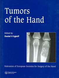 Produktbild: Tumors of the Hand: Published in Association with the Federation of European Societies for Surgery of the Hand