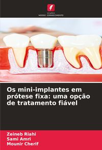 Produktbild: Os mini-implantes em pr&oacute;tese fixa: uma op&ccedil;&atilde;o de tratamento fi&aacute;vel