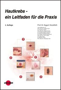 Produktbild: Hautkrebs - ein Leitfaden f&uuml;r die Praxis