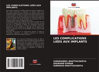Produktbild: Les Complications Li&eacute;es Aux Implants
