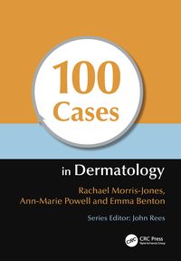 Produktbild: Powell, A: 100 Cases in Dermatology