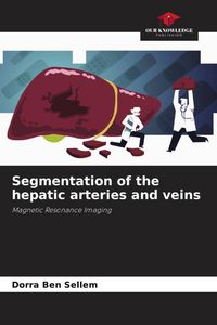 Produktbild: Segmentation of the hepatic arteries and veins