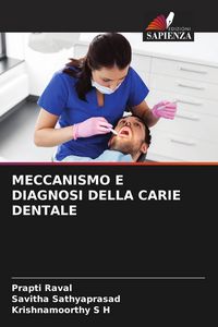 Produktbild: Meccanismo E Diagnosi Della Carie Dentale