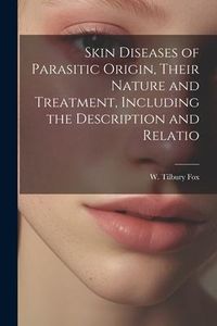 Produktbild: Skin Diseases of Parasitic Origin, Their Nature and Treatment, Including the Description and Relatio