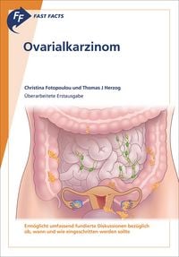 Produktbild: Fast Facts: Ovarialkarzinom