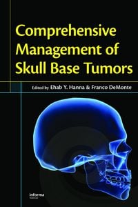 Produktbild: Comprehensive Management of Skull Base Tumors
