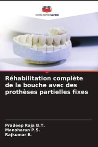 Produktbild: R&eacute;habilitation compl&egrave;te de la bouche avec des proth&egrave;ses partielles fixes