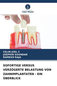 Produktbild: Sofortige Versus Verz&ouml;gerte Belastung von Zahnimplantaten - ein &Uuml;berblick