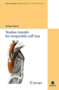 Produktbild: Tendon transfer for irreparable cuff tear
