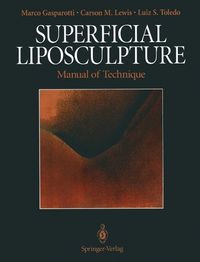 Produktbild: Superficial Liposculpture