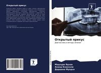 Produktbild: Otkrytyj prikus