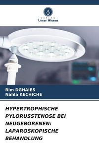 Produktbild: Hypertrophische Pylorusstenose bei Neugeborenen: Laparoskopische Behandlung
