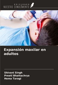 Produktbild: Expansi&oacute;n maxilar en adultos