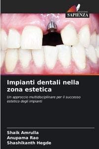 Produktbild: Impianti dentali nella zona estetica