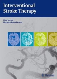 Produktbild: Interventional Stroke Therapy