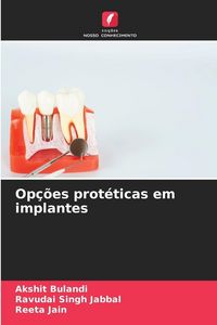 Produktbild: Op&ccedil;&otilde;es prot&eacute;ticas em implantes