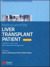 Produktbild: Medical Care of the Liver Transplant Patient