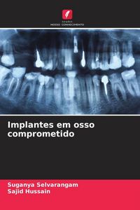 Produktbild: Implantes em osso comprometido