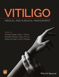 Produktbild: Vitiligo