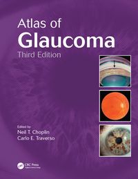 Produktbild: Atlas of Glaucoma