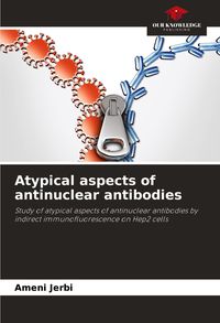 Produktbild: Atypical aspects of antinuclear antibodies