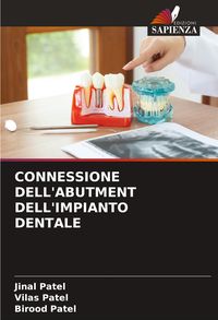 Produktbild: Connessione Dell'abutment Dell'impianto Dentale