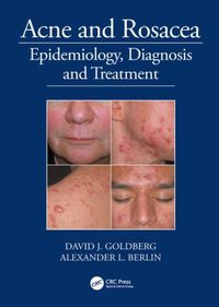 Produktbild: Goldberg, D: Acne and Rosacea