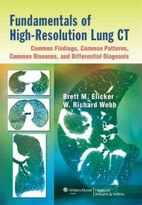 Produktbild: Elicker, B: Fundamentals of High-resolution Lung CT
