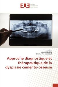 Produktbild: Approche diagnostique et th&eacute;rapeutique de la dysplasie c&eacute;mento-osseuse