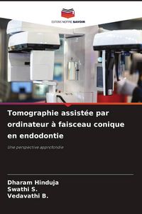 Produktbild: Tomographie assist&eacute;e par ordinateur &agrave; faisceau conique en endodontie