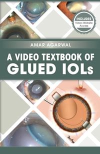 Produktbild: A Video Textbook of Glued IOLs