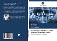 Produktbild: Misserfolge und Management von Implantatkrankheiten