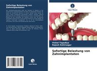 Produktbild: Sofortige Belastung von Zahnimplantaten