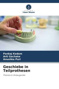 Produktbild: Geschiebe in Teilprothesen