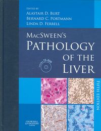 Produktbild: MacSween's Pathology of the Liver, w. CD-ROM
